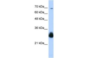 Western Blotting (WB) image for anti-Ring Finger Protein 138 (RNF138) antibody (ABIN2460633)