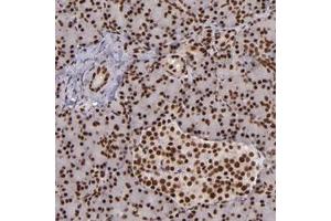 Immunohistochemical staining of human pancreas with PQBP1 polyclonal antibody  shows strong nuclear positivity in exocrine glandular cells and islet cells.