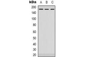 Western blot analysis of ATP7A expression in Hela (A), NIH3T3 (B), rat brain (C) whole cell lysates. (ATP7A antibody)