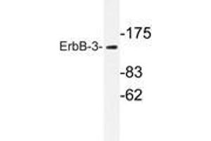 Western blot analysis of ErbB-3 antibody in extracts from 293 cells. (ERBB3 antibody)