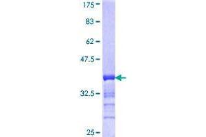 RSPH6A Protein (AA 21-113) (GST tag)