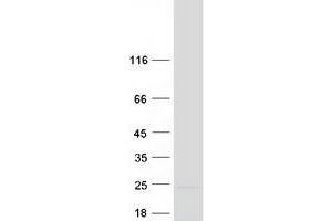 Western Blotting (WB) image for Processing of Precursor 5, Ribonuclease P/MRP Subunit (POP5) (Transcript Variant 1) protein (Myc-DYKDDDDK Tag) (ABIN2729367)