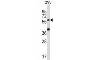 Western Blotting (WB) image for anti-Suppressor of Cytokine Signaling 6 (SOCS6) antibody (ABIN2997743)