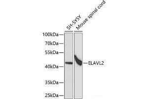 Western blot analysis of extracts of various cell lines using ELAVL2 Polyclonal Antibody at dilution of 1:1000. (ELAVL2 antibody)