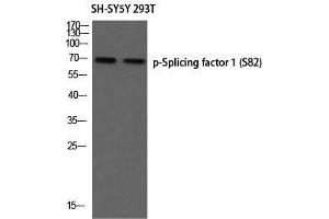 Western Blot (WB) analysis of SH-SY5Y 293T using p-Splicing factor 1 (S82) antibody. (Splicing Factor 1 antibody  (pSer82))