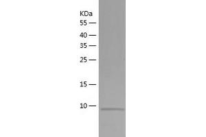 Western Blotting (WB) image for ATP-Binding Cassette, Sub-Family B (MDR/TAP), Member 5 (ABCB5) (AA 141-247) protein (His tag) (ABIN7287412) (ABCB5 Protein (AA 141-247) (His tag))