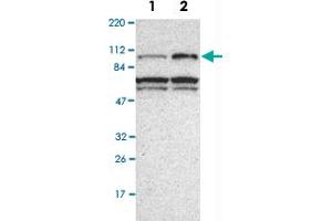 Western Blot analysis of Lane 1: RT-4 and Lane 2: U-251MG sp cell lysates with DDX20 polyclonal antibody . (DDX20 antibody)