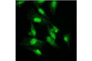 Immunofluorescenitrocellulosee of HeLa cells were stained by monoclonal anti-human GCN5L2 antibody (1:500) with Alexa 488 (Green). (KAT2A antibody  (AA 411-837))