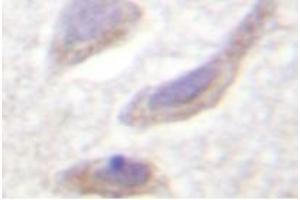 Image no. 1 for anti-Synuclein, alpha (SNCA) (pSer129) antibody (ABIN318305) (SNCA antibody  (pSer129))