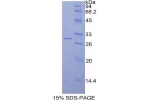 SDS-PAGE analysis of Rat IRAK2 Protein. (IRAK2 Protein)