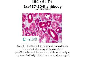 Image no. 2 for anti-Slit Homolog 1 (SLIT1) (AA 487-504) antibody (ABIN1739431) (SLIT1 antibody  (AA 487-504))