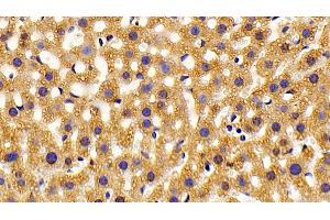 Immunohistochemistry (IHC) image for anti-Hydroxyacyl-CoA Dehydrogenase (HADH) (AA 1-167) antibody (ABIN7445141)