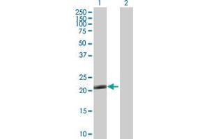 Western Blot analysis of TRIM48 expression in transfected 293T cell line by TRIM48 MaxPab polyclonal antibody. (TRIM48 antibody  (AA 1-208))