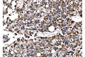 IHC analysis of Bim/BCL2L11 using anti-Bim/BCL2L11 antibody (ABIN7602855). (BIM antibody  (C-Term))