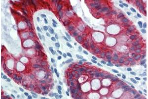 Colon, Human: Formalin-Fixed, Paraffin-Embedded (FFPE) (Cytokeratin 18 antibody)