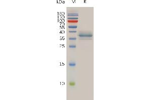 SDS-PAGE (SDS) image for Annexin A1 (ANXA1) (AA 2-346) protein (His tag) (ABIN7490974)