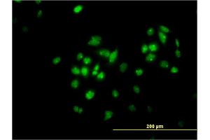 Immunofluorescence of monoclonal antibody to TFAP4 on HeLa cell. (TFAP4 antibody  (AA 93-192))