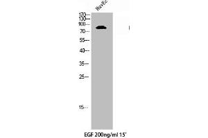 Western Blot analysis of HuvEc cells using Phospho-Axl (Y691) Polyclonal Antibody (AXL antibody  (pTyr691))