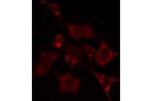 ABIN6274961 staining A549 by IF/ICC. (CA5A antibody  (Internal Region))