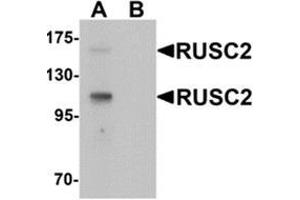 Western blot analysis of RUSC2 in SK-N-SH cell lysate with RUSC2 Antibody  at 1 ug/mL in (A) the absence and (B) the presence of blocking peptide (RUSC2 antibody  (N-Term))