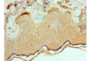 Immunohistochemistry of paraffin-embedded human skin tissue using ABIN7172544 at dilution of 1:100 (ETV6 antibody  (AA 1-300))
