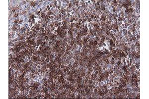 Immunohistochemistry (IHC) image for anti-T-cell surface glycoprotein CD1c (CD1C) antibody (ABIN2670667) (CD1c antibody)