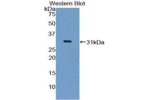 Western blot analysis of the recombinant protein. (ASK1 antibody  (AA 693-933))