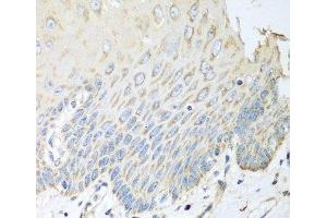 Immunohistochemistry of paraffin-embedded Human esophagus using SGCB Polyclonal Antibody at dilution of 1:100 (40x lens). (SGCB antibody)