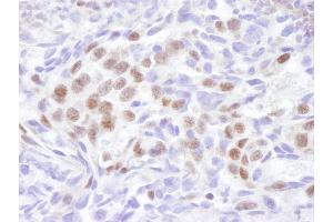 Immunohistochemistry (IHC) image for anti-Ubiquitin Protein Ligase E3 Component N-Recognin 5 (UBR5) (AA 600-650) antibody (ABIN7448540)