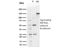 SDS-PAGE Analysis Purified CHP2 Mouse Monoclonal Antibody (CPTC-CHP2-1). (Chp2 antibody)