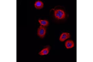 ABIN6264528 and ABIN6266732 staining Hela by IF/ICC. (PTTG1 antibody  (Internal Region))