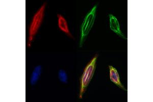 ABIN6260189 and ABIN6268682 staining Hela by IF/ICC. (BAG1 antibody  (N-Term))