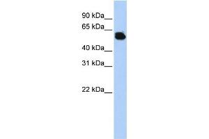FTCD antibody used at 1 ug/ml to detect target protein.