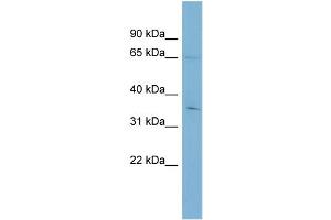WB Suggested Anti-YTHDF1  Antibody Titration: 0. (YTHDF1 antibody  (Middle Region))