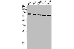 Western Blot analysis of 823 293T 22RV1 Hela HepG2 cells using ATP5A Polyclonal Antibody (ATP5A1 antibody  (Internal Region))