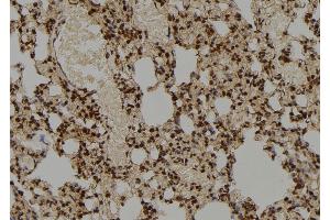 ABIN6276865 at 1/100 staining Rat lung tissue by IHC-P. (COPS5 antibody  (Internal Region))