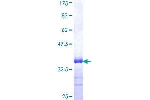 SLIT3 Protein (AA 1371-1470) (GST tag)
