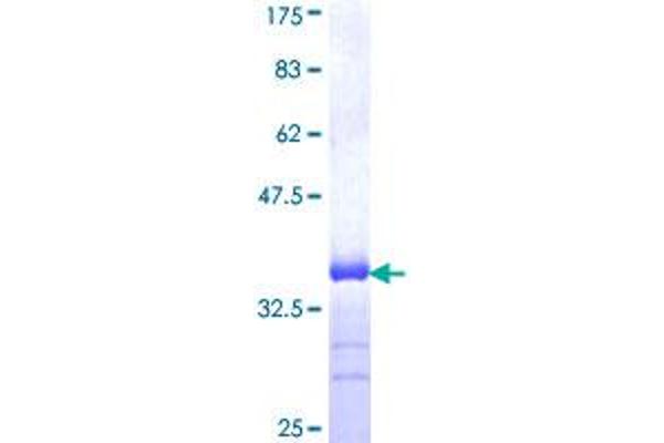 SLIT3 Protein (AA 1371-1470) (GST tag)