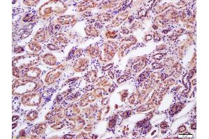 Formalin-fixed and paraffin embedded human kidney labeled with Anti-AMPK beta 2 Polyclonal Antibody, Unconjugated (ABIN751858) at 1:200 followed by conjugation to the secondary antibody and DAB staining (PRKAB1 antibody  (AA 201-272))