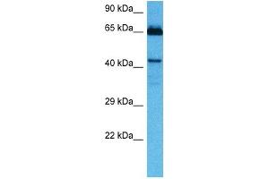 Host:  Mouse  Target Name:  HOXA10  Sample Tissue:  Mouse Kidney  Antibody Dilution:  1ug/ml (HOXA10 antibody  (Middle Region))