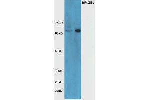 Lane 1: mouse brain lysate Lane 2: Raji cell lysate probed with Rabbit Anti-HRG beta 1 Polyclonal Antibody, Unconjugated (ABIN716051) at 1:300 overnight at 4 °C. (Hrg beta 1 (AA 65-150) antibody)