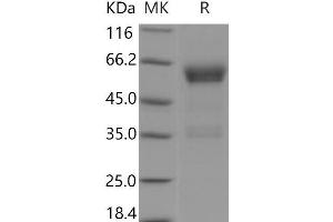 Western Blotting (WB) image for Paired Immunoglobin-Like Type 2 Receptor beta (PILRB) protein (Fc Tag) (ABIN7320361)