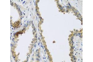 Immunohistochemistry of paraffin-embedded Human prostate using GFER Polyclonal Antibody at dilution of 1:100 (40x lens). (GFER antibody)