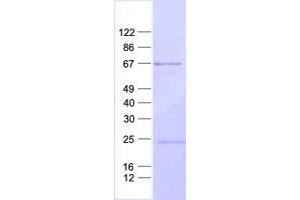 Validation with Western Blot (SOCS5 Protein (His tag))