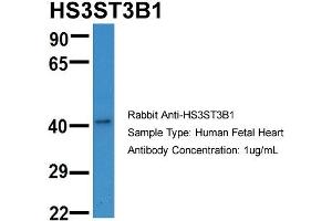 Host:  Rabbit  Target Name:  HS3ST3B1  Sample Type:  Human Fetal Heart  Antibody Dilution:  1. (HS3ST3B1 antibody  (N-Term))