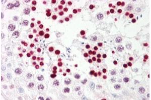Anti-p53 antibody IHC staining of human testis. (p53 antibody  (AA 344-393))