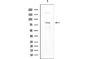 Western blot analysis of lysates from COLO205 cells(heat-shock treatment), using Phospho-MeCP2 (Ser80) Antibody at 1/1000 dilution.