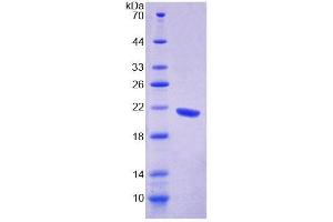 SDS-PAGE analysis of Human GFM1 Protein. (GFM1 Protein)