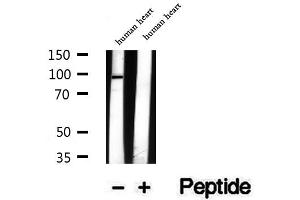 Western blot analysis of extracts of human heart tissue, using TRPC4AP antibody.