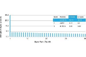 Protein Array (PAr) image for anti-Aldehyde Dehydrogenase 1 Family, Member A1 (ALDH1A1) antibody (ABIN7456058)